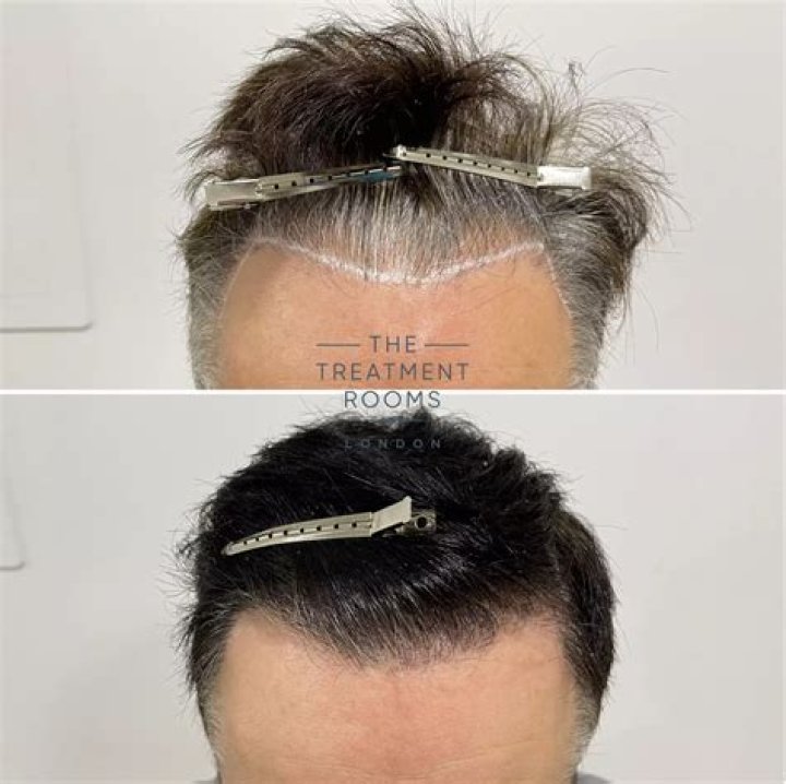 Did Mark Womack Get A Hair Transplant Surgery? The Responder Cast Hair Treatment Rumors Explored