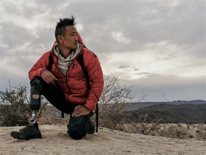 Dr Albert Lin Wikipedia Biography – What Happened To His Leg?