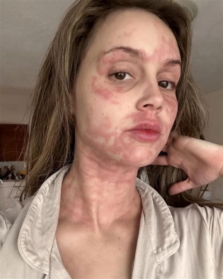 Heather Gray Disease: What illness did Heather Gray suffer from?