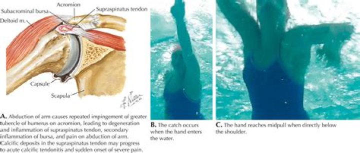 
How did Christopher Dowling die ?Former Water polo player and swimmer Cause of death explained 