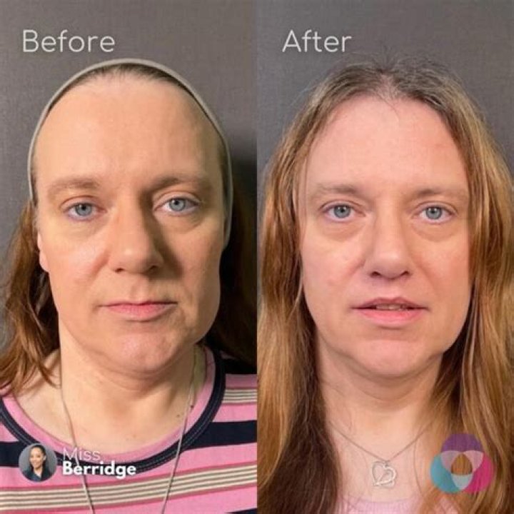 Man Or Woman: Is Zion Moreno Transgender? Before And After Surgery Pictures