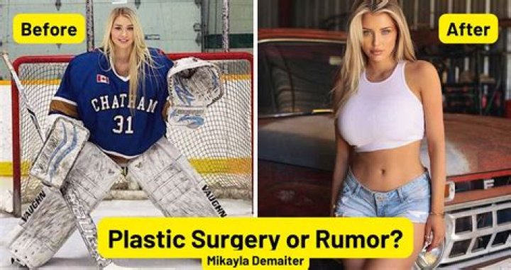 Mikayla Demaiter | Plastic Surgery | Before And After