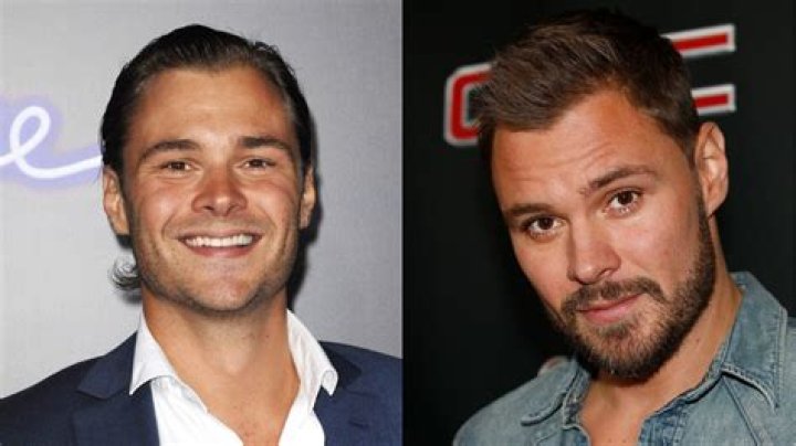Patrick Flueger Face and Plastic Surgery Concerns Addressed