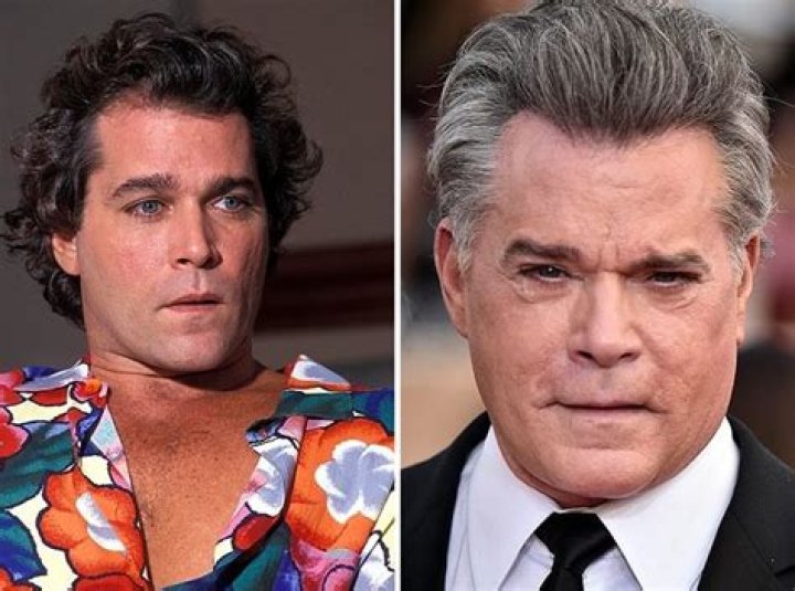 What Happened To Ray Liotta Face? Had He Done The Plastic Surgery