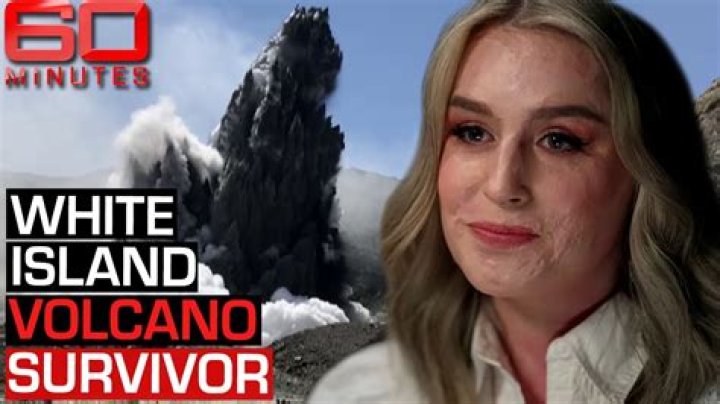 
What Happened To Stephanie Browitt Face? 60 Minutes Unmask The Story Of White Island Volcano Survivor 