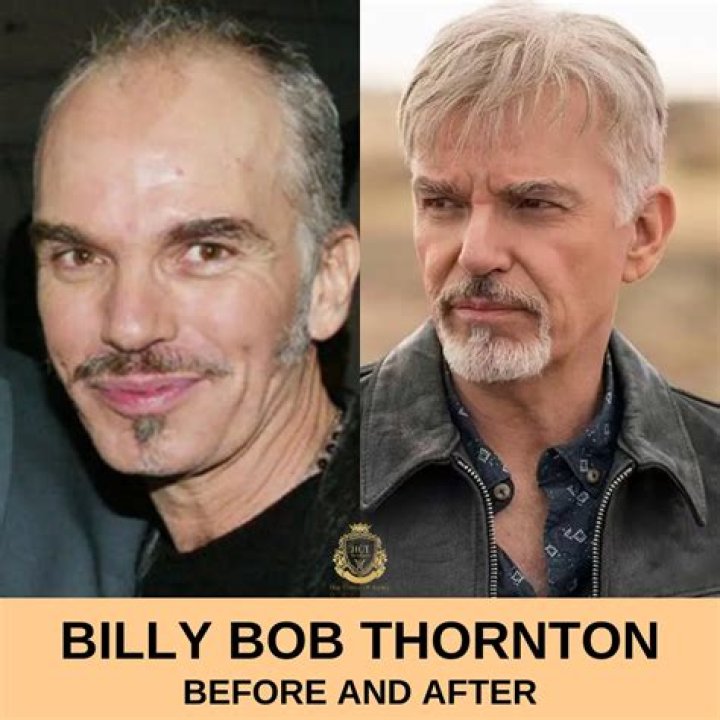 What is Billy Bob Thornton like in real life? Does Billy Bob Thornton have a wig?