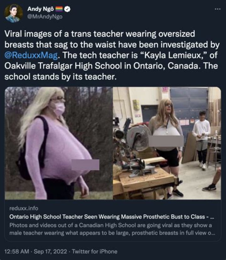
What Is The Trans Canadian Teacher Prosthetic Controversy? 