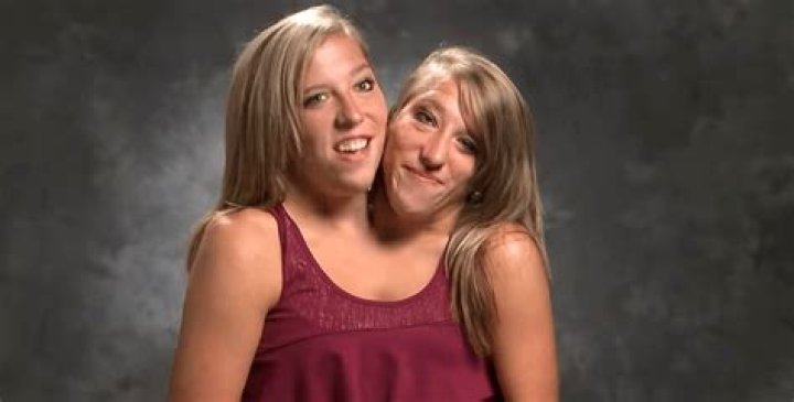 Where are Abby and Brittany Hensel in 2022? They are fifth-grade teachers